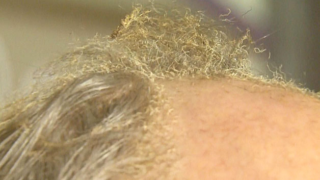 Owner Paul Klemm's hair and eyebrows were singed in the explosion. (WBZ-TV)